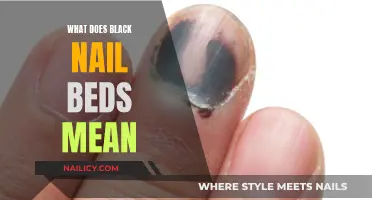 Black Nail Beds: What Do They Mean for Your Health?