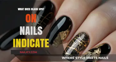 Black Spots on Nails: Causes, Concerns, and When to Seek Help