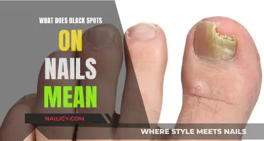 Uncover the Mystery: Black Spots on Your Nails