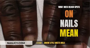 Black Spots on Nails: What Your Body Is Trying to Tell You