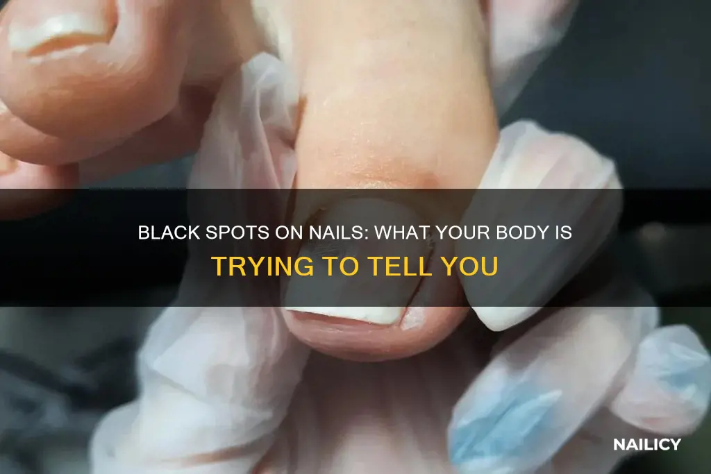 what does black spots on nails mean