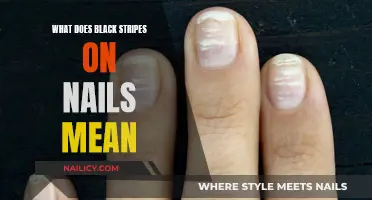 Unraveling the Mystery: Black Streaks on Your Nails