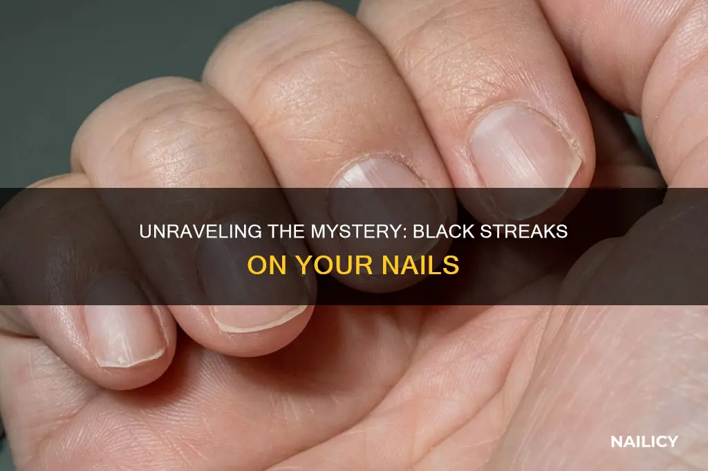 what does black stripes on nails mean