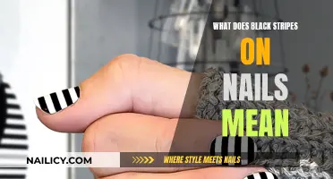 Black Nail Stripes: What Do They Mean?