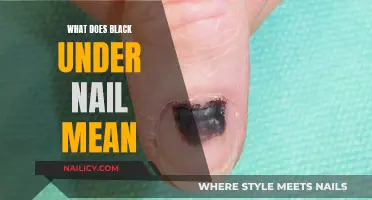 Unraveling the Mystery: What Does Black Under Your Nail Mean?