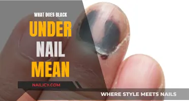 The Mystery of Black Under Nails: What Does It Mean?