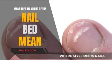 Understanding Blanching: A Guide to Nail Bed Changes