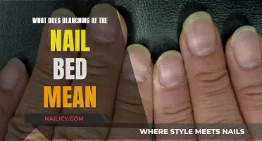 Understanding Nail Bed Blanching: What Does It Mean?