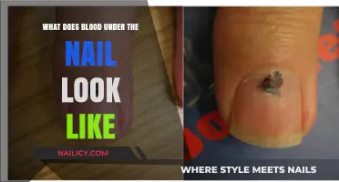 What Does Blood Under the Nail Look Like: A Visual Guide