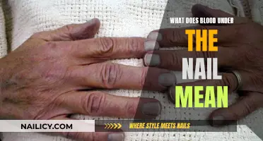 Blood Under the Nail: What Does it Mean?