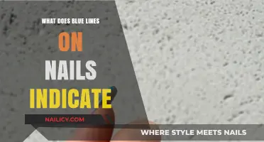 Blue Lines on Nails: Uncovering Hidden Health Signals and Causes