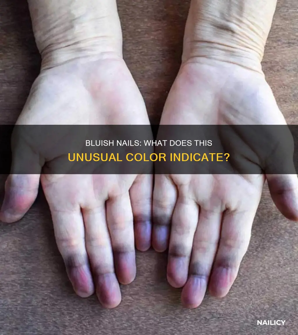 what does bluish nails mean
