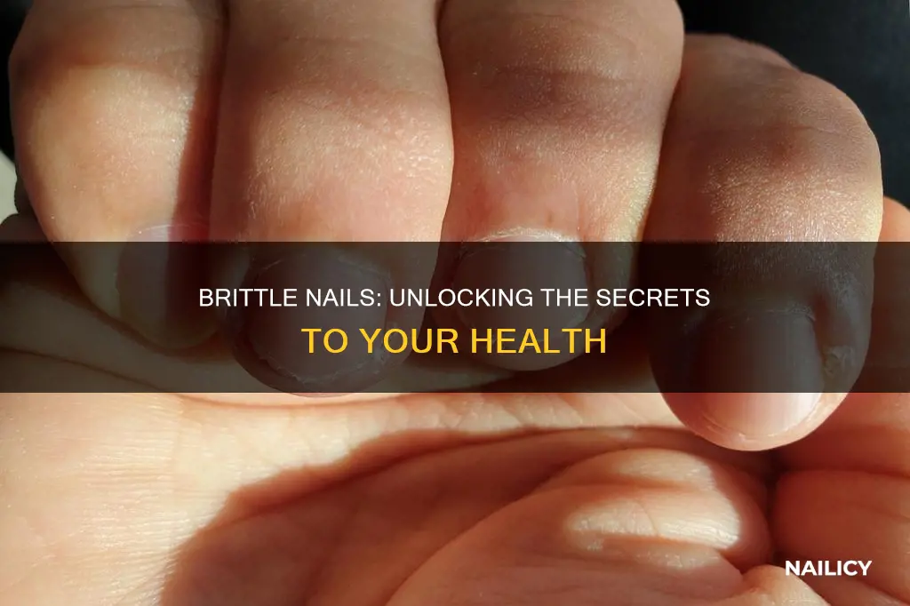 what does brittle nails mean about your health