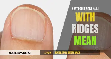 Understanding Brittle Nails with Ridges: Causes and Solutions