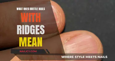 Brittle Nails: What Do Ridges Mean?