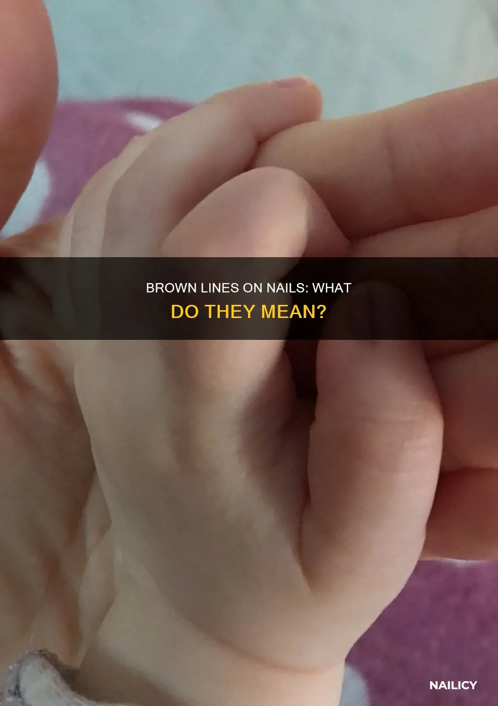 what does brown line in nail mean