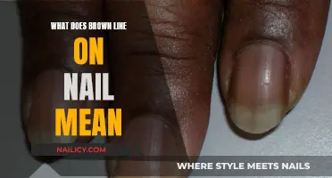 Unraveling the Mystery: What Does a Brown Line on Your Nail Indicate?