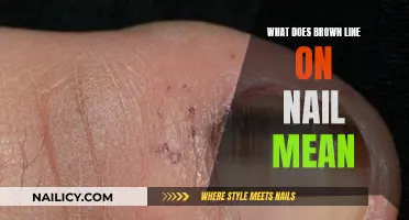 Brown Lines on Nails: What Do They Mean?