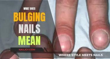 Bulging Nails: What Do They Mean for Your Health?