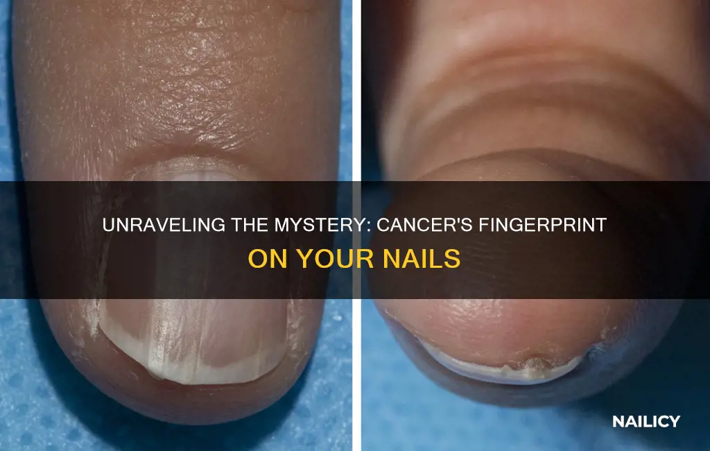 what does cancer in the finger nail look like