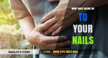 Celiac Disease and Nail Health: Symptoms, Changes, and Care Tips
