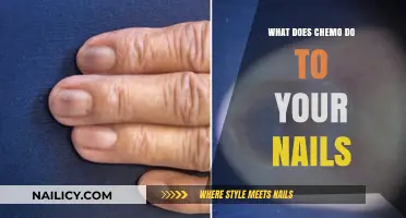 Chemotherapy's Impact: Understanding Nail Changes and How to Manage Them