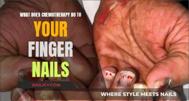 Chemotherapy's Impact: How It Affects Your Fingernails