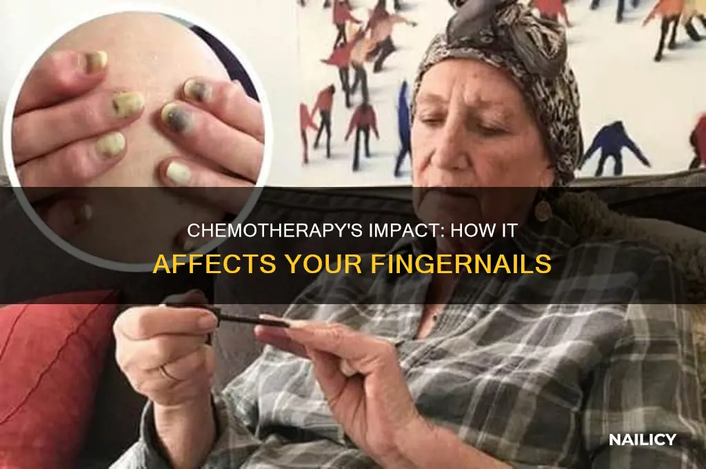 what does chemotherapy do to your finger nails