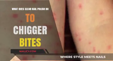 Clear Nail Polish for Chigger Bites: Relief or Myth?