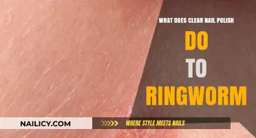 Clear Nail Polish on Ringworm: Does It Help or Harm?