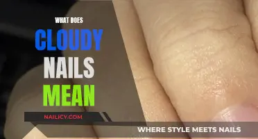 Unraveling the Mystery: Cloudy Nails and Their Significance