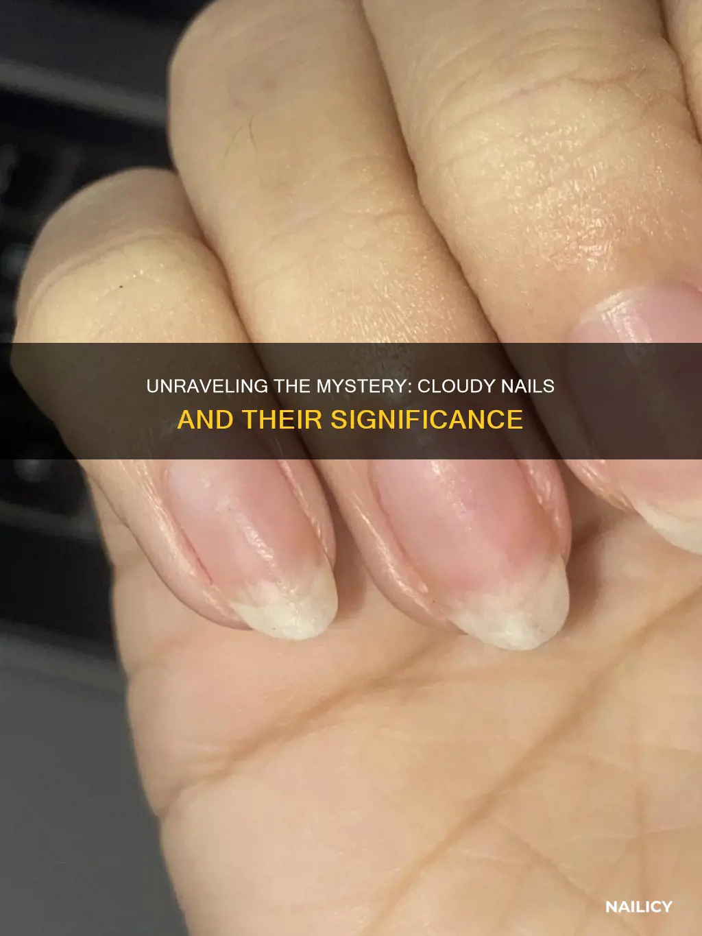 what does cloudy nails mean