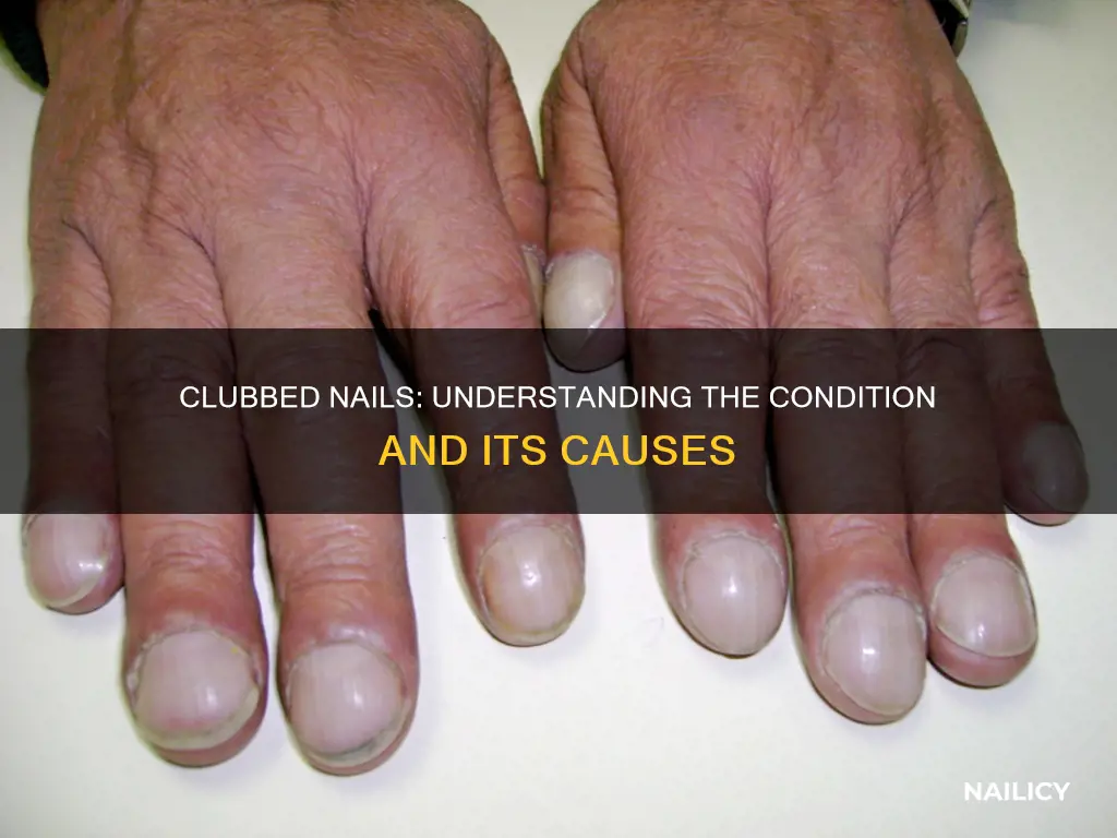 what does clubbed nails mean