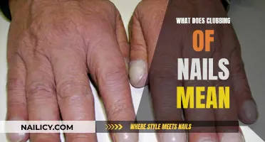 Unraveling the Mystery: Clubbing of Nails Explained