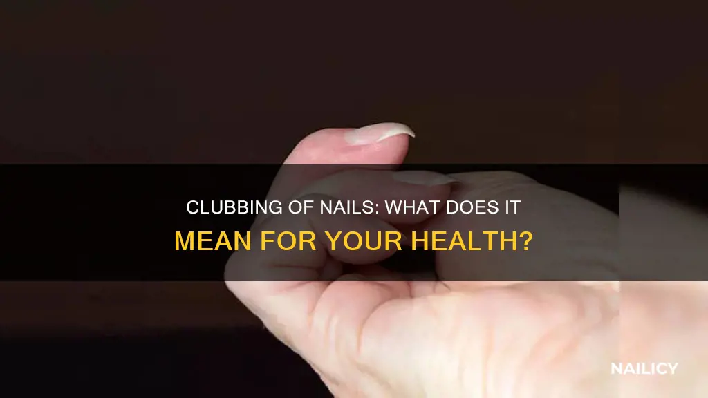 what does clubbing of nails mean