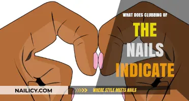 Clubbing of the Nails: Uncovering Hidden Health Clues and Conditions