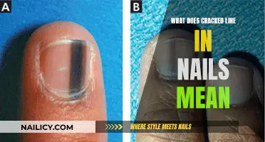 Unraveling the Mystery: What Your Cracked Nails Say About Your Health