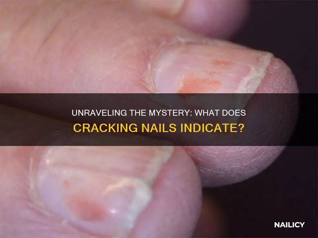 what does cracking nails mean