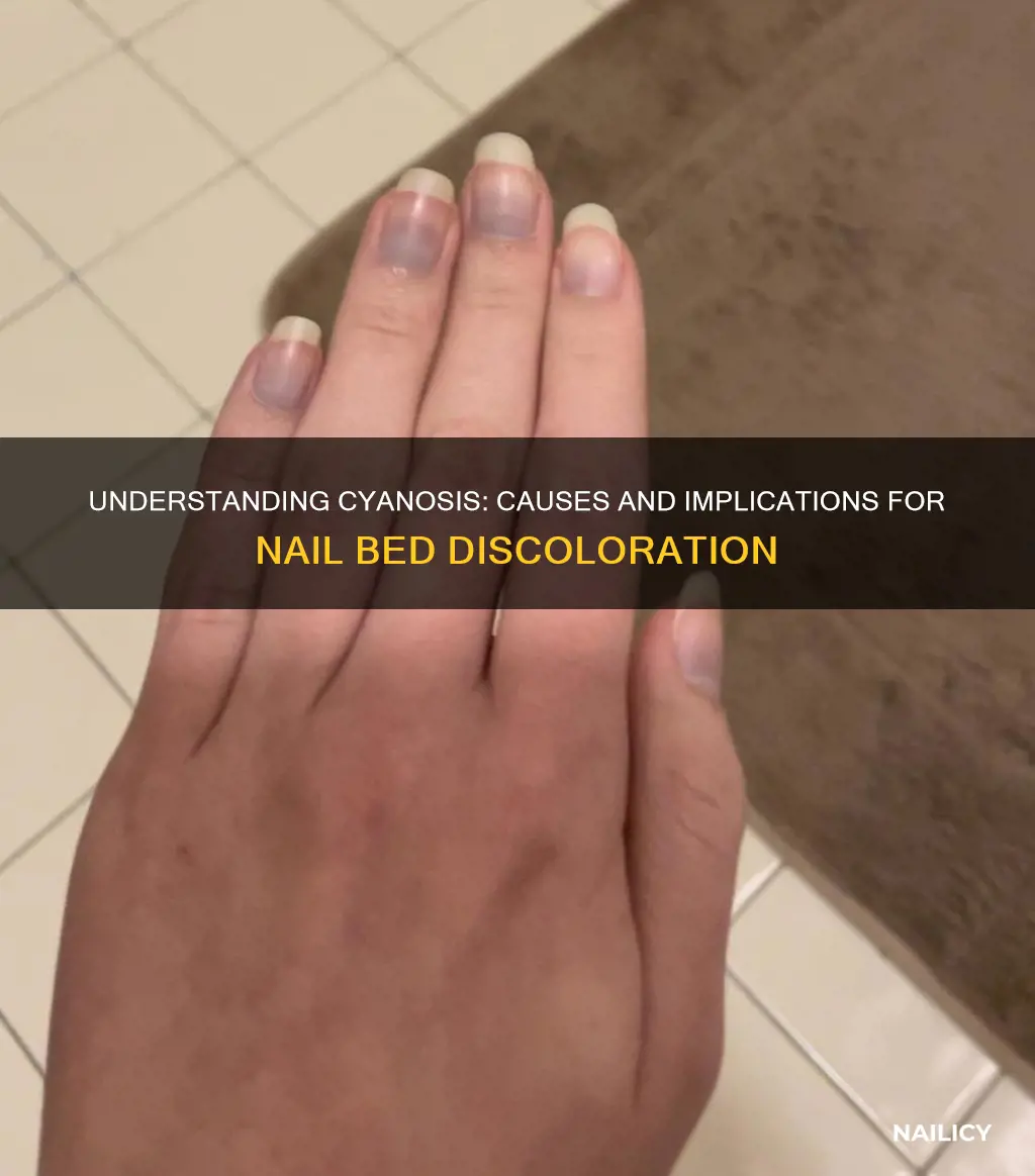 what does cyanosis means if identifyed in nails bed