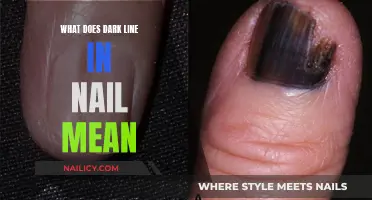 Understanding Dark Lines on Your Nails: Causes and Concerns