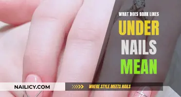 Dark Lines Under Nails: What's the Underlying Health Concern?