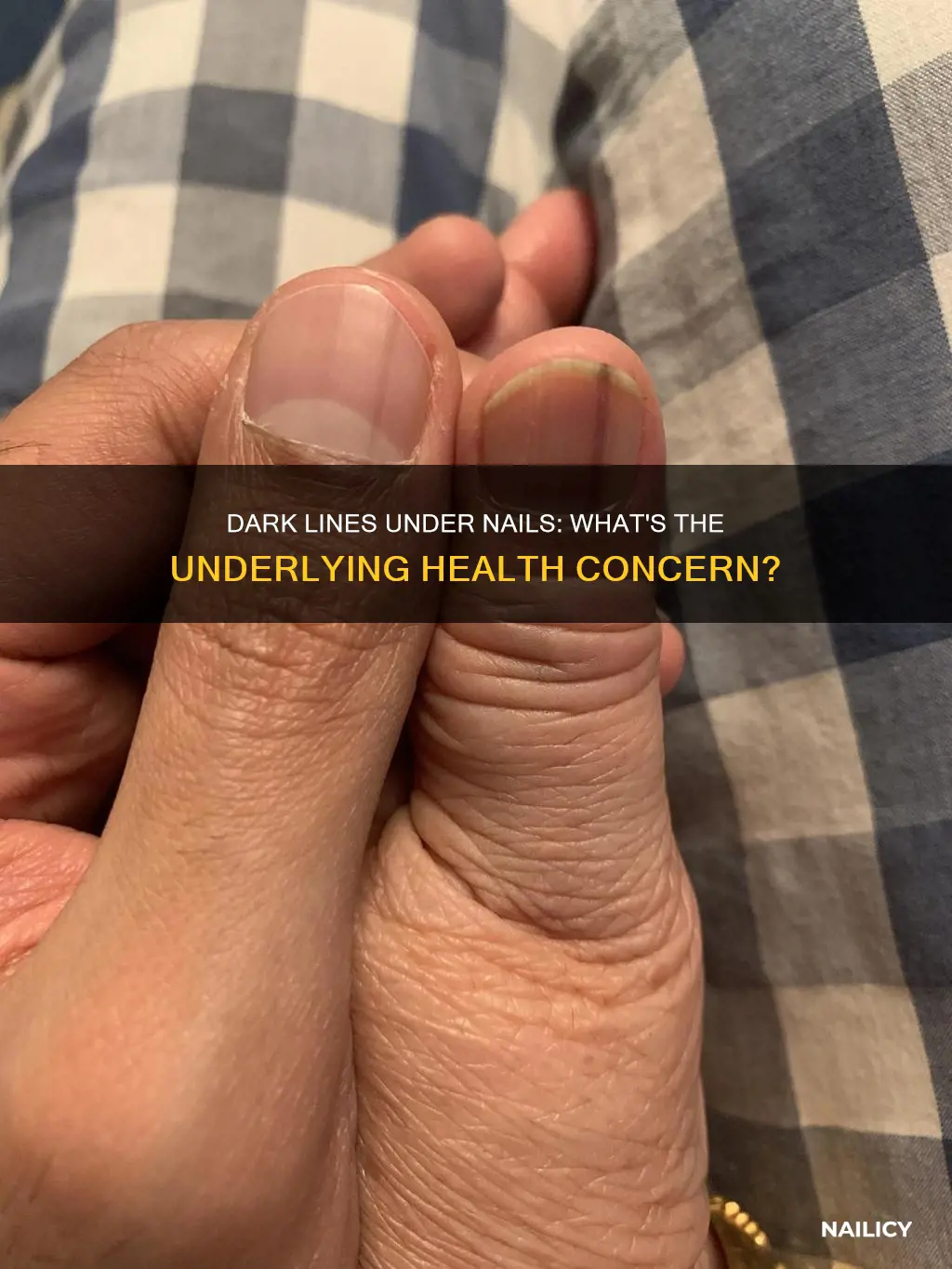 what does dark lines under nails mean