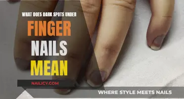 Dark Spots Under Fingernails: What Do They Mean?