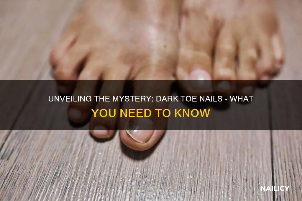 what does dark toe nails mean