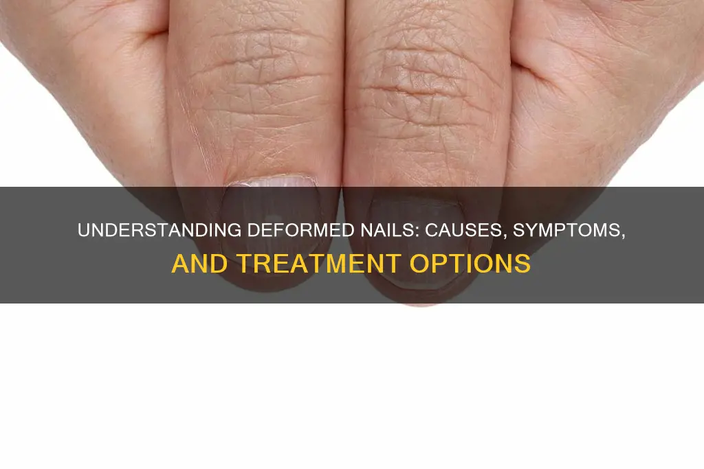 what does deformed nails mean