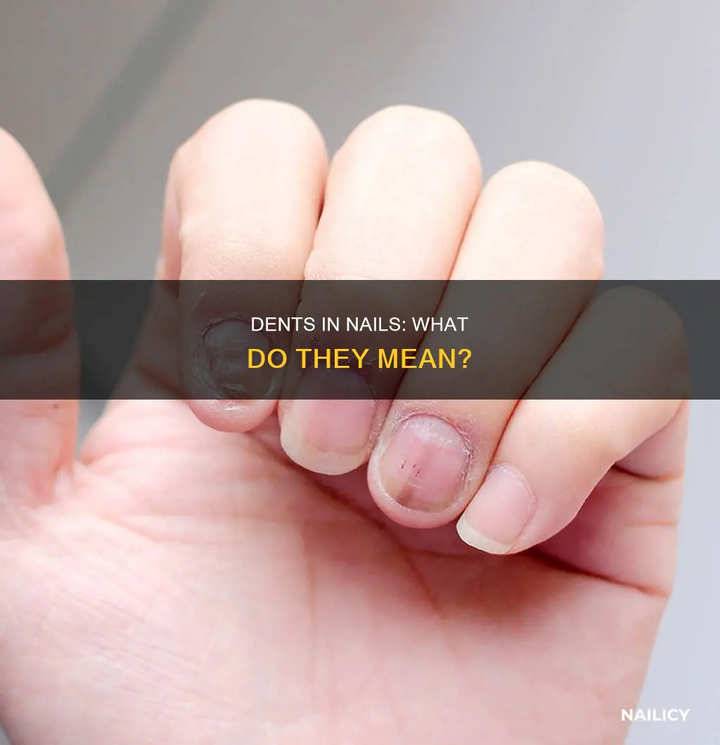 what does dents in some of my nails mean
