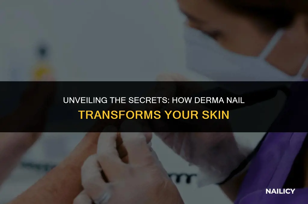 what does derma nail do
