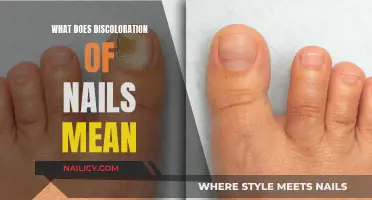 Nail Discoloration: What Your Nails Are Trying to Tell You