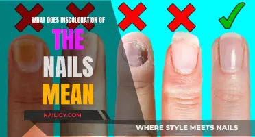 Uncover the Hidden Meaning Behind Nail Discoloration