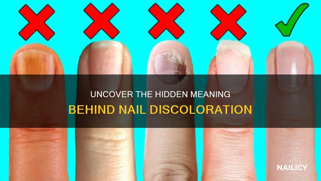 what does discoloration of the nails mean